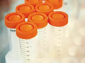Glaxosmithkline